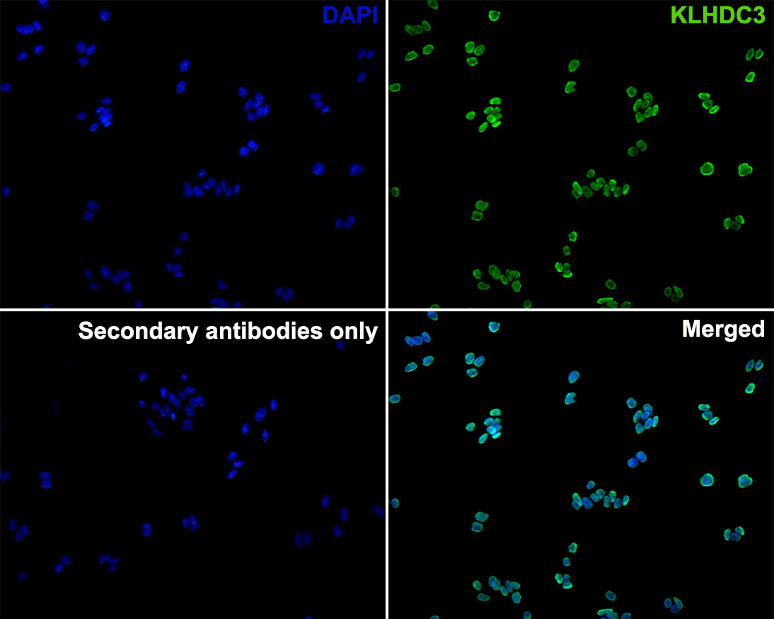 Immunocytochemistry analysis of PC-3 cells labeling KLHDC3 with Mouse anti-KLHDC3 antibody (M1310-1) at 1/200 dilution.<br />
<br />
Cells were fixed in 4% paraformaldehyde for 10 minutes at 37 ℃, permeabilized with 0.05% Triton X-100 in PBS for 20 minutes, and then blocked with 2% negative goat serum for 30 minutes at room temperature. Cells were then incubated with Mouse anti-KLHDC3 antibody (M1310-1) at 1/200 dilution in 2% negative goat serum overnight at 4 ℃. Goat Anti-Mouse IgG H&L (iFluor™ 488, HA1125) was used as the secondary antibody at 1/1,000 dilution. PBS instead of the primary antibody was used as the secondary antibody only control. Nuclear DNA was labelled in blue with DAPI.