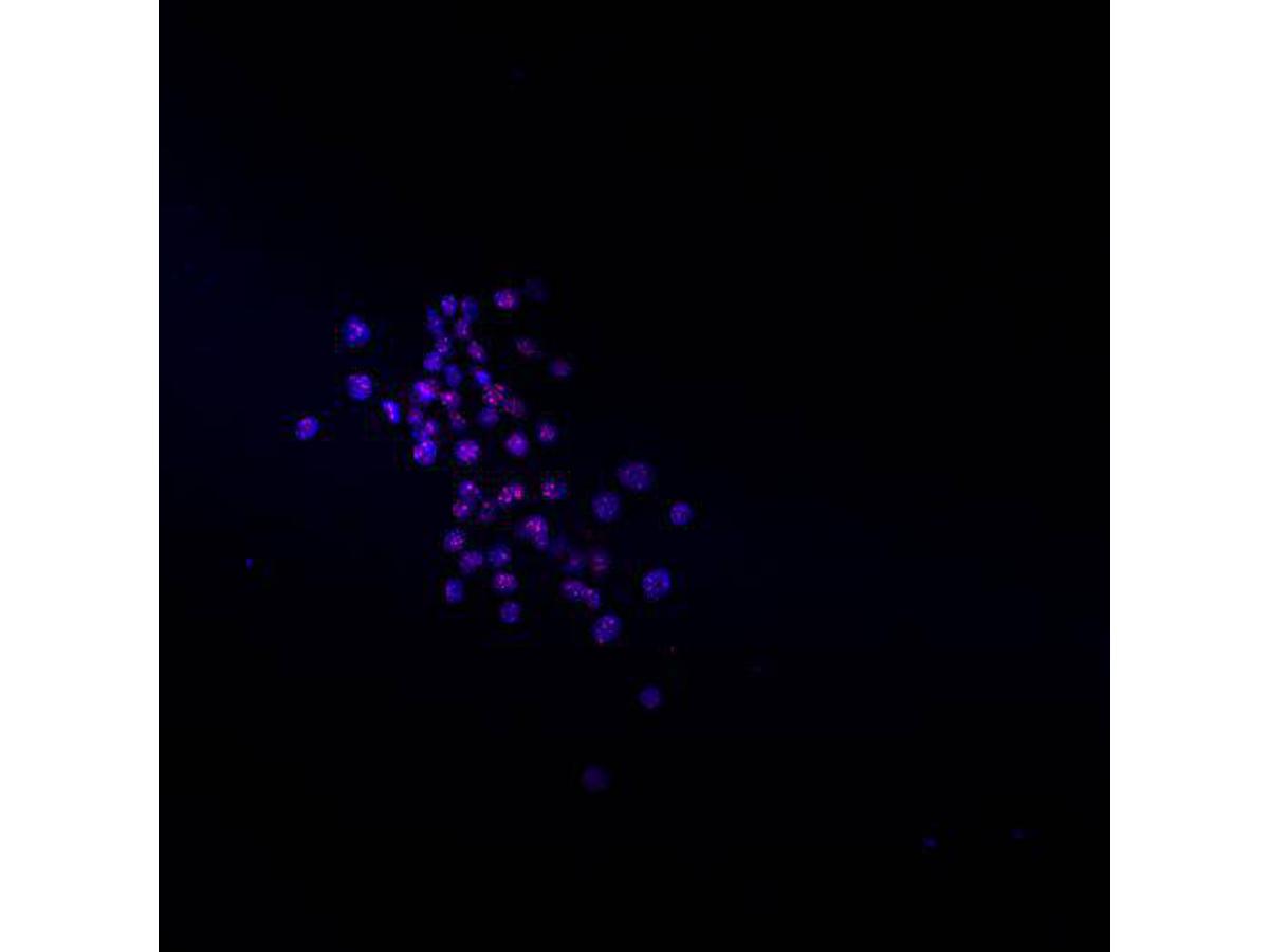 ICC staining ATRX in mouse embryonic cells D3 (red). Cells were fixed in paraformaldehyde, permeabilised with 0.25% Triton X100/PBS.