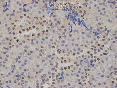 Immunohistochemical analysis of paraffin-embedded mouse kidney tissue using anti- ATRX mouse monoclonal antibody.