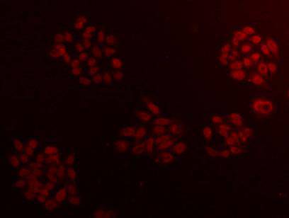 ICC staining CCDC111 in HepG2 cells(red). Cells were fixed in paraformaldehyde, permeabilised with 0.25% Triton X100/PBS.
