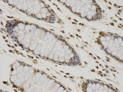 Immunohistochemical analysis of paraffin-embedded human colonic tissue using anti- CCDC111 mouse monoclonal antibody.