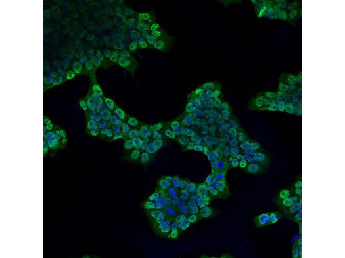 ICC staining Lin28B in NCCIT cells (green). Cells were fixed in paraformaldehyde, permeabilised with 0.25% Triton X100/PBS. and counterstained with DAPI in order to highlight the nucleus (blue).