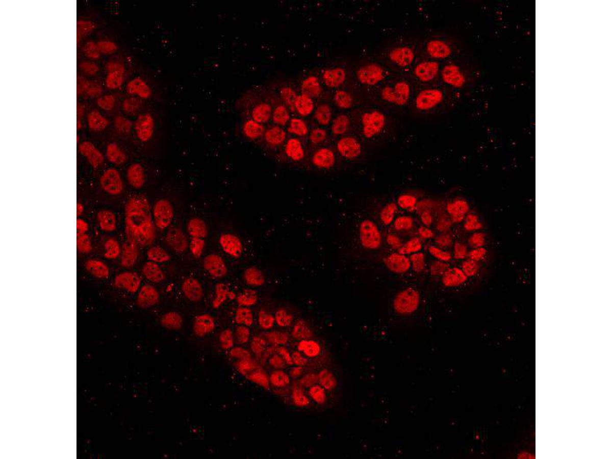 ICC staining p53 in A431 cells (red). Cells were fixed in paraformaldehyde, permeabilised with 0.25% Triton X100/PBS.