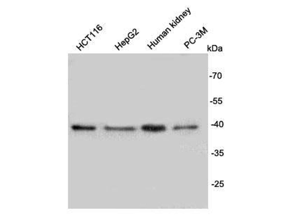 Western blot analysis on different cell lysates using anti-Rem2 mouse mAb.