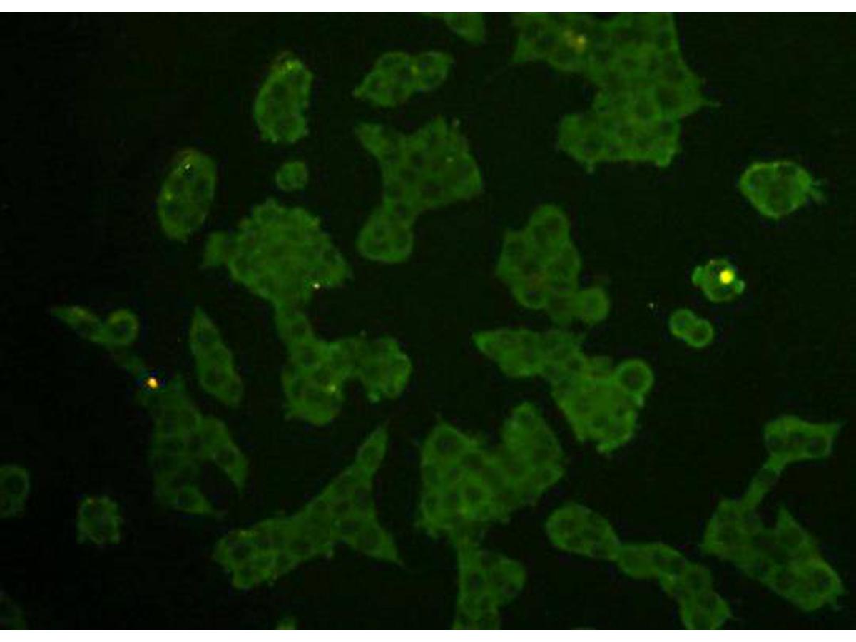 ICC staining Rem2 in NCCIT cells(green). Cells were fixed in paraformaldehyde, permeabilised with 0.25% Triton X100/PBS.