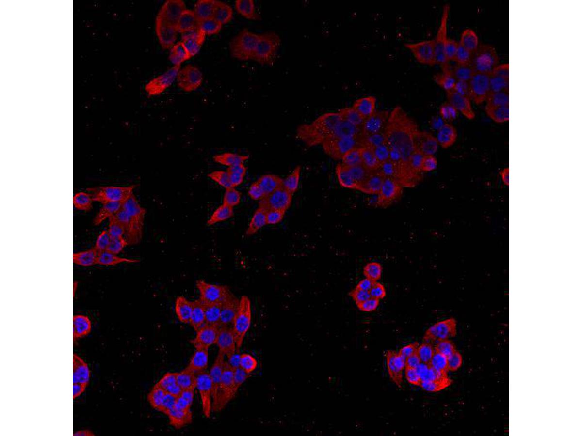 ICC staining PODXL in HCT116 cells (red). Cells were fixed in paraformaldehyde, permeabilised with 0.25% Triton X100/PBS.