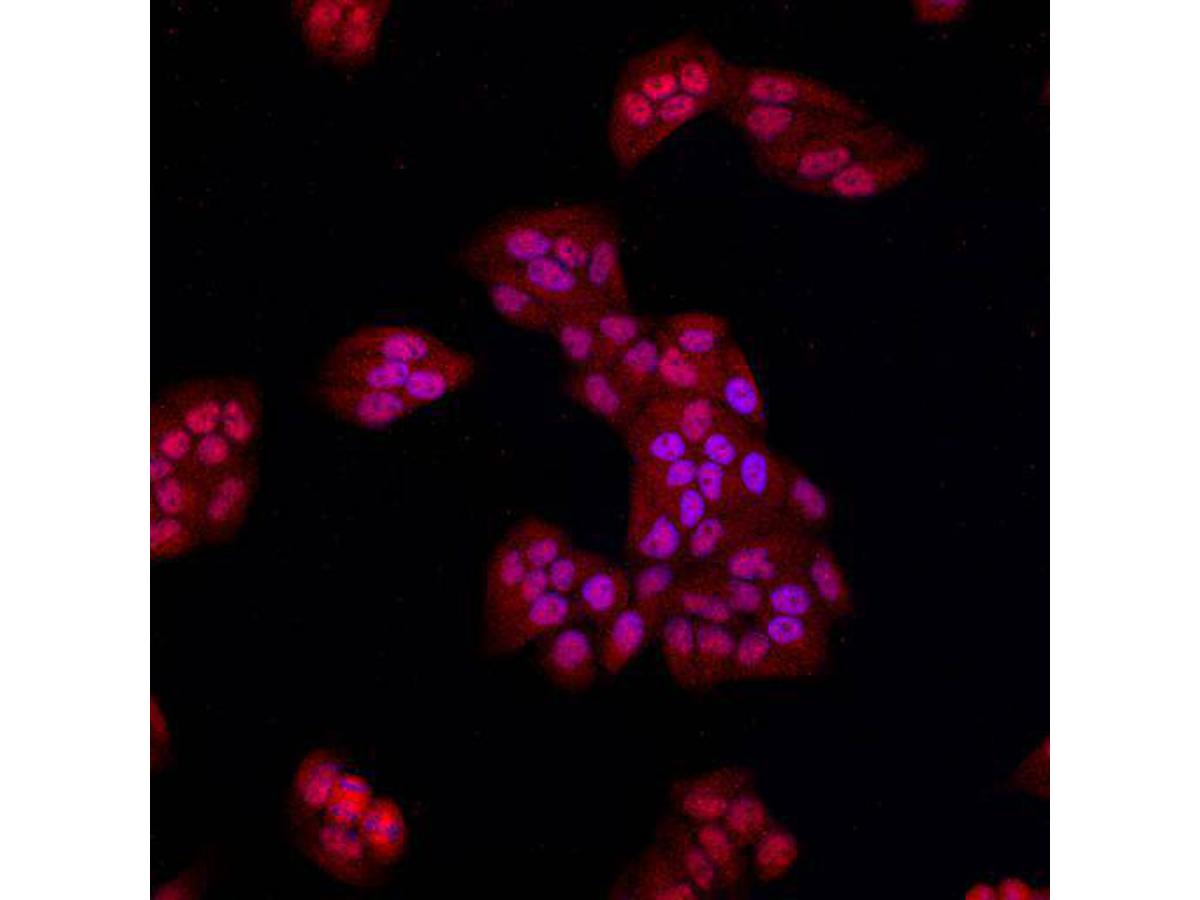 ICC staining Beta-catenin in Hela cells (red). Cells were fixed in paraformaldehyde, permeabilised with 0.25% Triton X100/PBS and counterstained with DAPI in order to highlight the nucleus (blue).