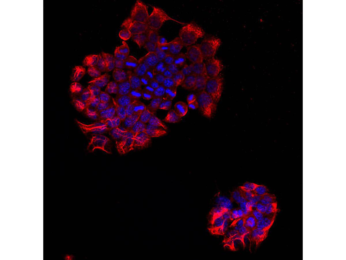 ICC staining PTPRB in F9 cells (red). Cells were fixed in paraformaldehyde, permeabilised with 0.25% Triton X100/PBS and counterstained with DAPI in order to highlight the nucleus (blue).