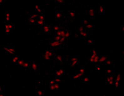ICC staining AMPK alpha 1 in PANC-1 cells (red). Cells were fixed in paraformaldehyde, permeabilised with 0.25% Triton X100/PBS.