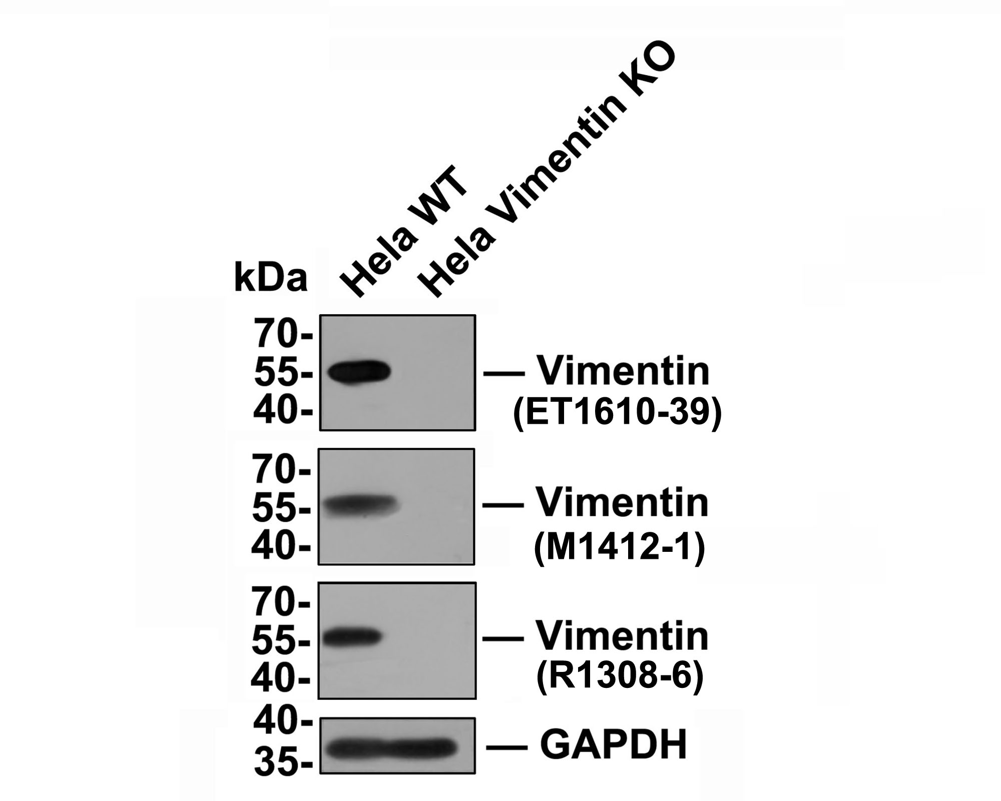 All lanes: Western blot analysis of Vimentin with anti-Vimentin antibody (M1412-1) at 1:500 dilution.<br />
Lane 1: Wild-type Hela whole cell lysate (10 µg).<br />
Lane 2: Vimentin knockout Hela whole cell lysate (10 µg).<br />
<br />
M1412-1 was shown to specifically react with Vimentin in wild-type Hela cells. No band was observed when Vimentin knockout sample was tested. Wild-type and Vimentin knockout samples were subjected to SDS-PAGE. Proteins were transferred to a PVDF membrane and blocked with 5% NFDM in TBST for 1 hour at room temperature. The primary antibody (M1412-1, 1:500) was used in 5% BSA at room temperature for 2 hours. Goat Anti-Mouse IgG-HRP Secondary Antibody (HA1006) at 1:100,000 dilution was used for 1 hour at room temperature.