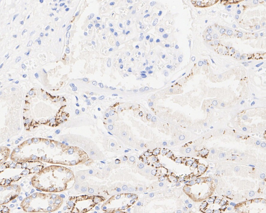 Immunohistochemical analysis of paraffin-embedded Human small intestine using anti-CLDN7 antibody. The section was pre-treated using heat mediated antigen retrieval with Tris-EDTA buffer (pH 8.0-8.4) for 20 minutes.The tissues were blocked in 5% BSA for 30 minutes at room temperature, washed with ddH2O and PBS, and then probed with the primary antibody (M1412-2, 1/100) for 30 minutes at room temperature. The detection was performed using an HRP conjugated compact polymer system. DAB was used as the chromogen. Tissues were counterstained with hematoxylin and mounted with DPX.