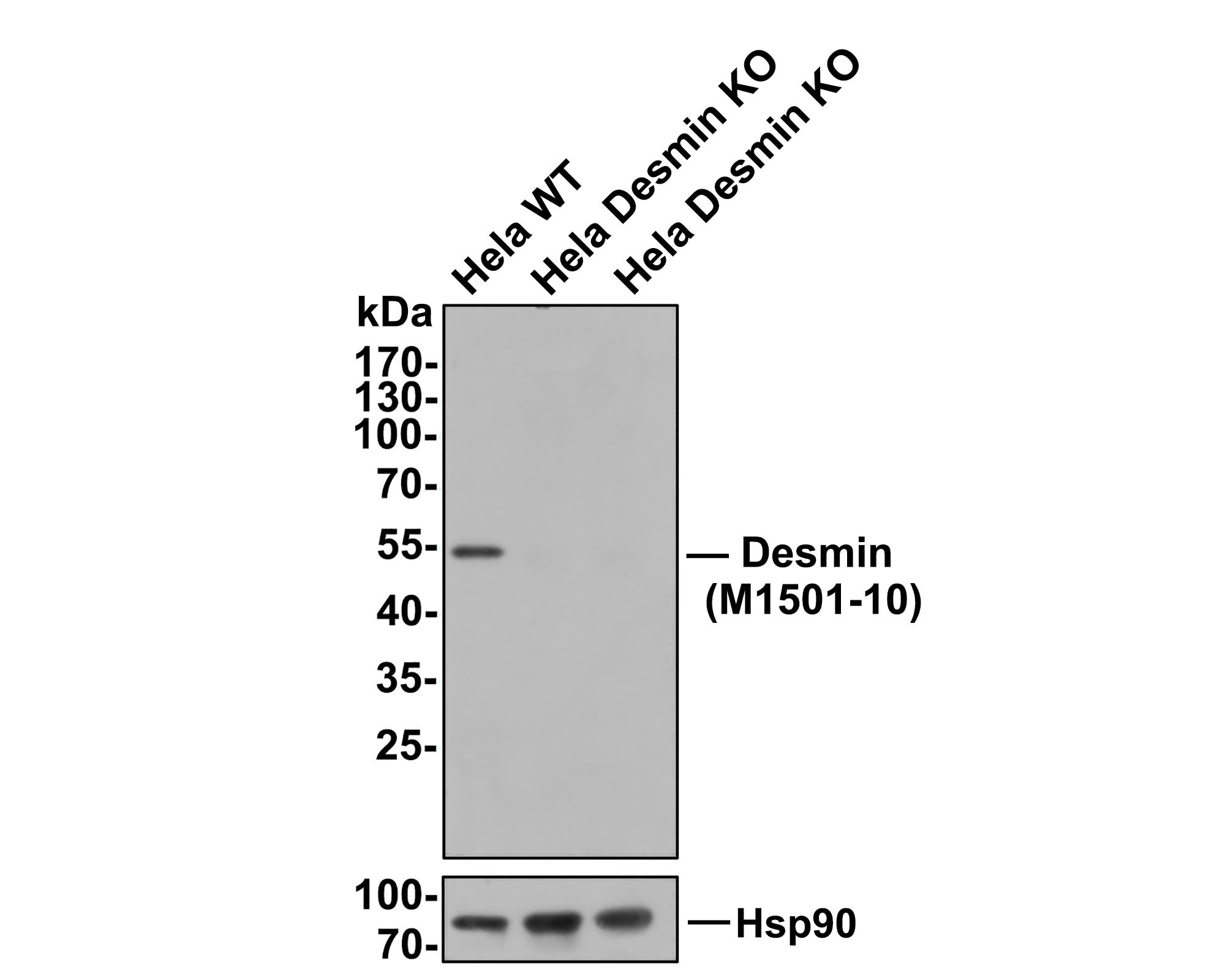 All lanes: Western blot analysis of Desmin with anti-Desmin antibody (M1501-10) at 1:500 dilution.<br />
Lane 1: Wild-type Hela whole cell lysate (10 µg).<br />
Lane 2/3: Desmin knockout Hela whole cell lysate (10 µg).<br />
<br />
M1501-10 was shown to specifically react with Desmin in wild-type Hela cells. NO bands were observed when Desmin knockout sample were tested. Wild-type and Desmin knockout samples were subjected to SDS-PAGE. Proteins were transferred to a PVDF membrane and blocked with 5% NFDM in TBST for 1 hour at room temperature. The primary antibody (M1501-10, 1:500) was used in 5% BSA at room temperature for 2 hours. Goat anti-Mouse IgG-HRP antibody (HA1006) at 1:50,000 dilution was used for 1 hour at room temperature.