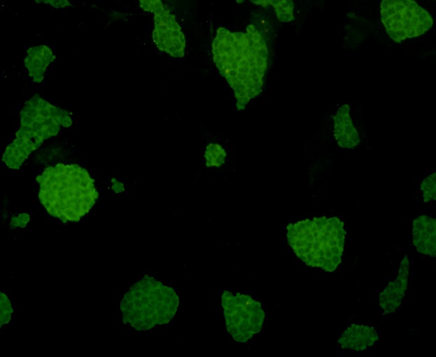 ICC staining Desmin in D3 cells (green). Formalin fixed cells were permeabilized with 0.1% Triton X-100 in TBS for 10 minutes at room temperature and blocked with 1% Blocker BSA for 15 minutes at room temperature. Cells were probed with Desmin monoclonal antibody at a dilution of 1:100 for 1 hour at room temperature, washed with PBS. Alexa Fluorc™ 488 Goat anti-Mouse IgG was used as the secondary antibody at 1/100 dilution.