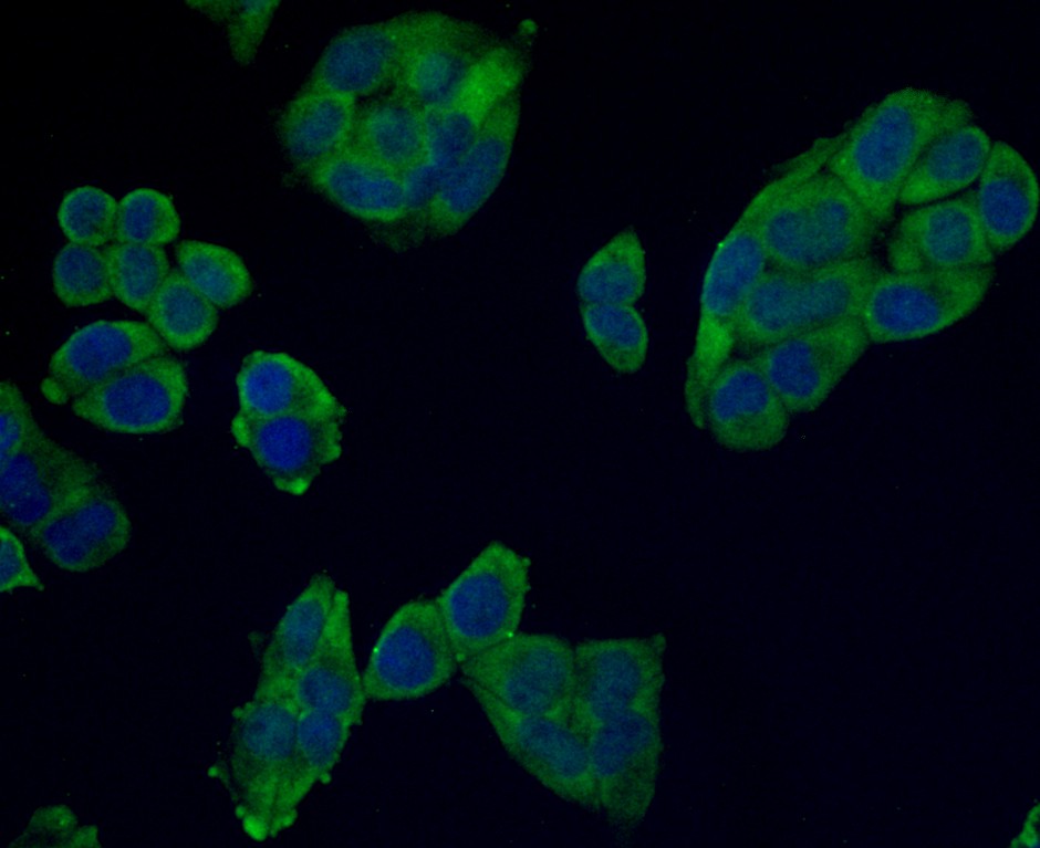 ICC staining Desmin in Hela cells (green). Formalin fixed cells were permeabilized with 0.1% Triton X-100 in TBS for 10 minutes at room temperature and blocked with 1% Blocker BSA for 15 minutes at room temperature. Cells were probed with Desmin monoclonal antibody at a dilution of 1:100 for 1 hour at room temperature, washed with PBS. Alexa Fluorc™ 488 Goat anti-Mouse IgG was used as the secondary antibody at 1/100 dilution. The nuclear counter stain is DAPI (blue).