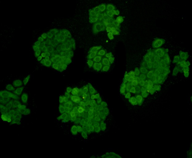 ICC staining Desmin in HepG2 cells (green). Formalin fixed cells were permeabilized with 0.1% Triton X-100 in TBS for 10 minutes at room temperature and blocked with 1% Blocker BSA for 15 minutes at room temperature. Cells were probed with Desmin monoclonal antibody at a dilution of 1:100 for 1 hour at room temperature, washed with PBS. Alexa Fluorc™ 488 Goat anti-Mouse IgG was used as the secondary antibody at 1/100 dilution.