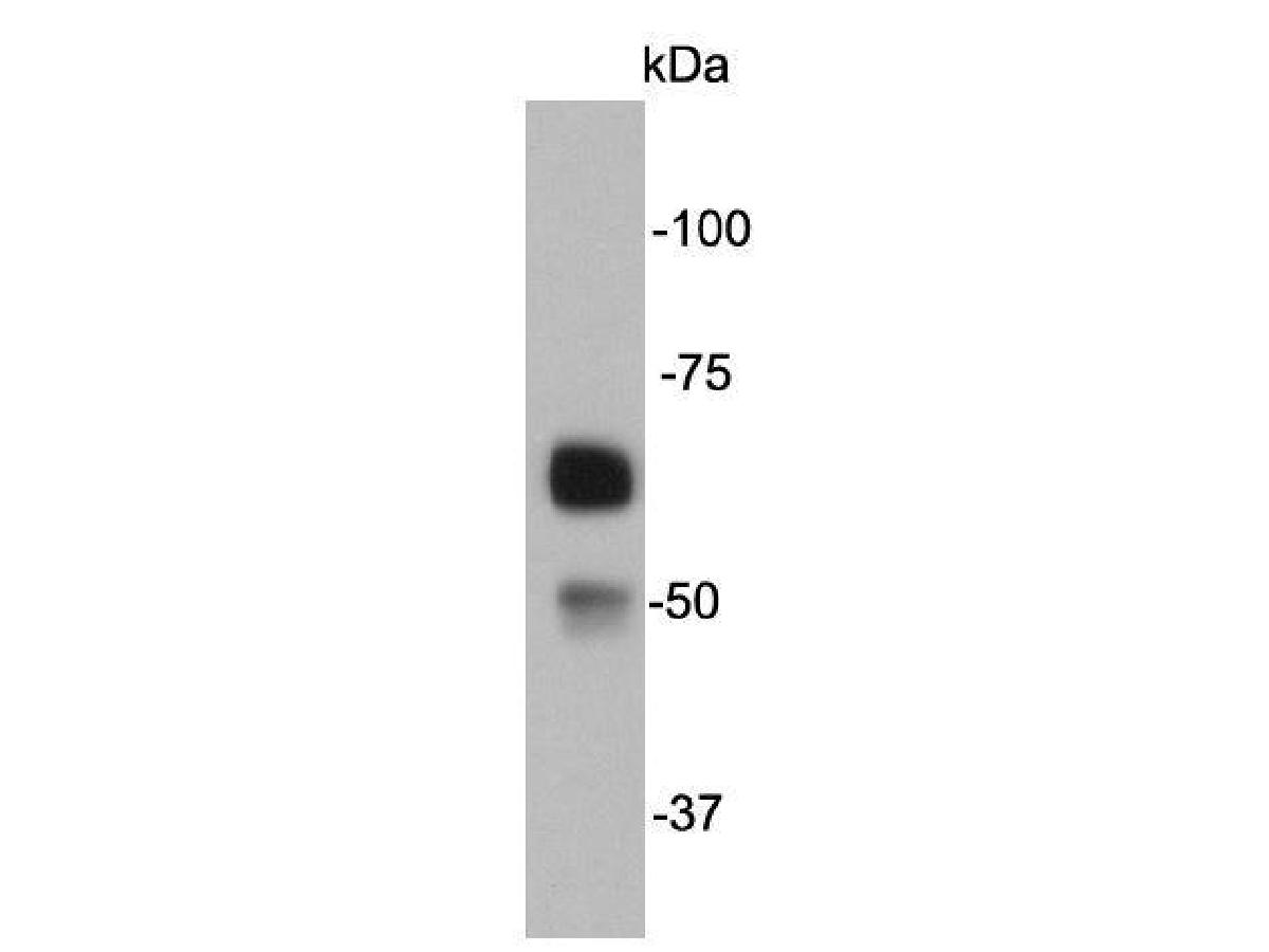 Western blot analysis on mouse liver lysates using anti-catalse mouse mAb.