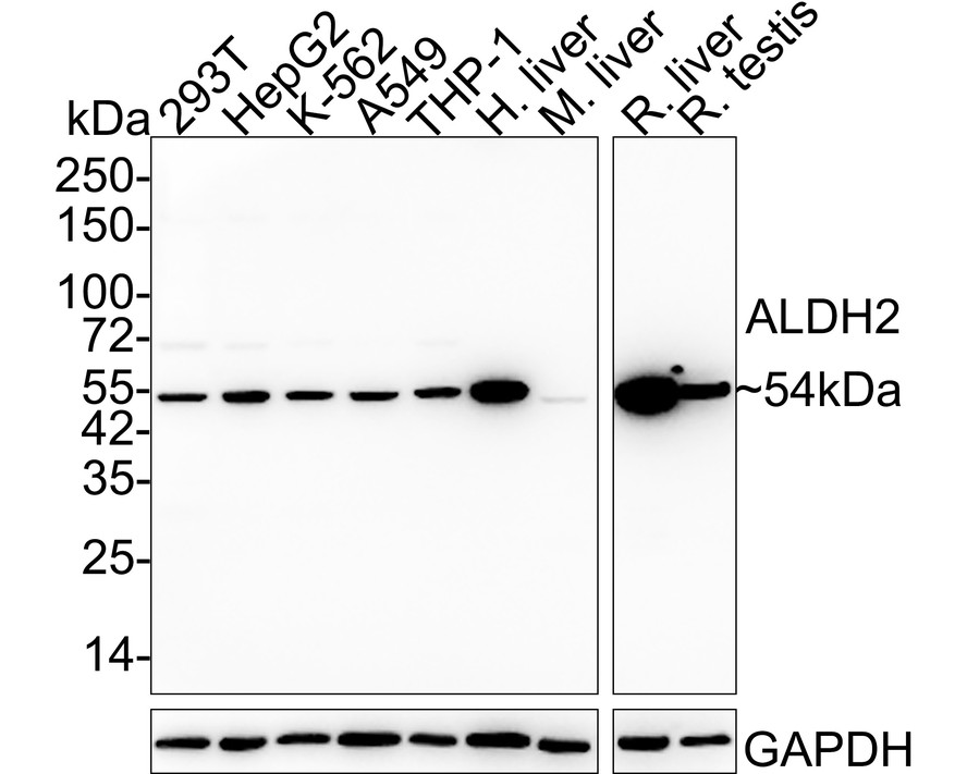 Western blot analysis of ALDH2 on different lysates with Mouse anti-ALDH2 antibody (M1501-7) at 1/1,000 dilution.<br />
<br />
Lane 1: 293T cell lysate (20 µg/Lane)<br />
Lane 2: HepG2 cell lysate (20 µg/Lane)<br />
Lane 3: K-562 cell lysate (20 µg/Lane)<br />
Lane 4: A549 cell lysate (20 µg/Lane)<br />
Lane 5: THP-1 cell lysate (20 µg/Lane)<br />
Lane 6: Human liver tissue lysate (40 µg/Lane)<br />
Lane 7: Mouse liver tissue lysate (40 µg/Lane)<br />
Lane 8: Rat liver tissue lysate (40 µg/Lane)<br />
Lane 9: Rat testis tissue lysate (40 µg/Lane)<br />
<br />
Predicted band size: 56 kDa<br />
Observed band size: 54 kDa<br />
<br />
Exposure time: 1 minute 30 seconds;<br />
<br />
4-20% SDS-PAGE gel.<br />
<br />
Proteins were transferred to a PVDF membrane and blocked with 5% NFDM/TBST for 1 hour at room temperature. The primary antibody (M1501-7) at 1/1,000 dilution was used in 5% NFDM/TBST at 4℃ overnight. Goat Anti-Mouse IgG - HRP Secondary Antibody (HA1006) at 1/50,000 dilution was used for 1 hour at room temperature.