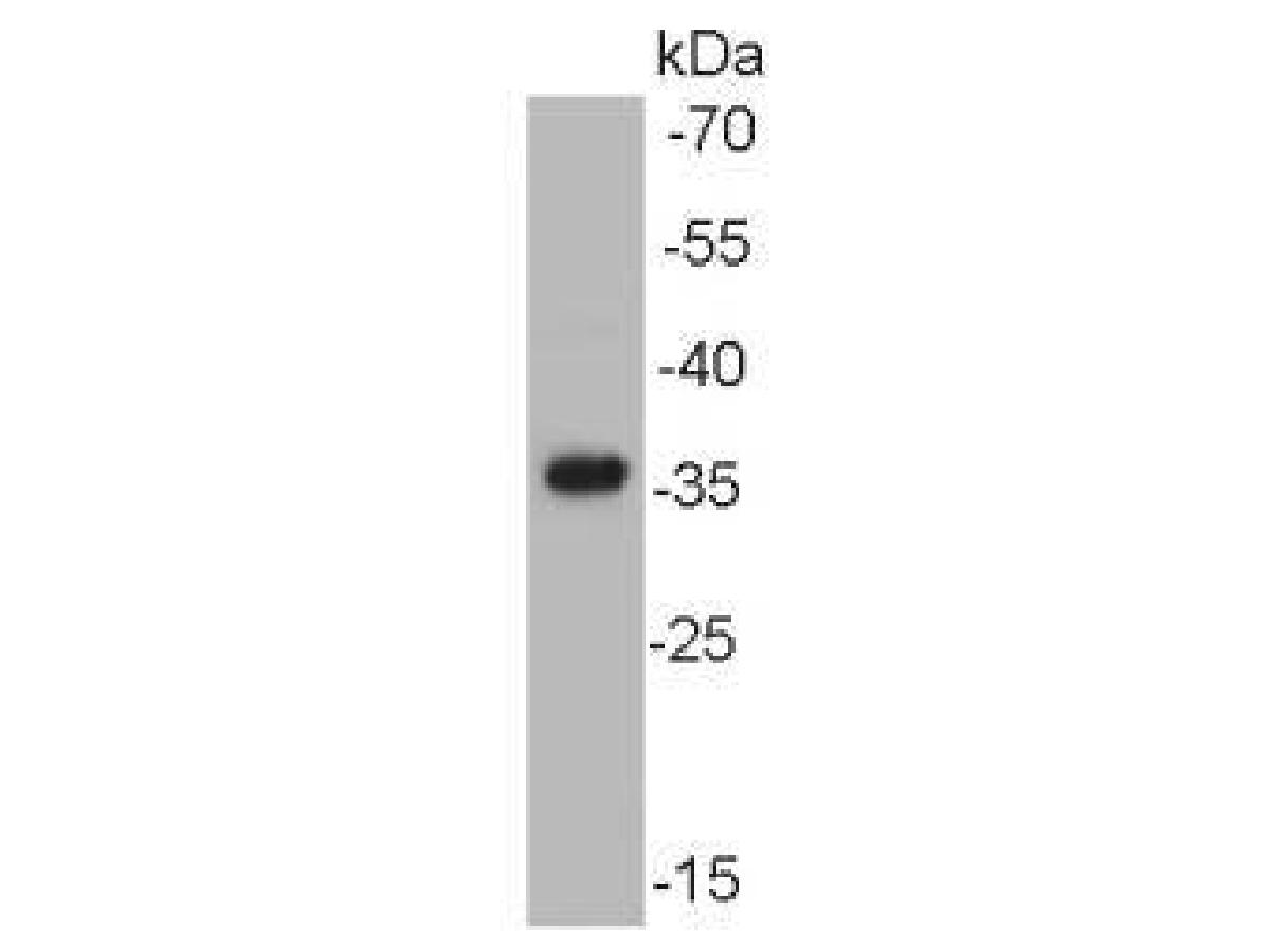 Western blot analysis of AKR7A2 on human spermatozoa lysate using anti-AKR7A2 antibody at 1/1,000 dilution.