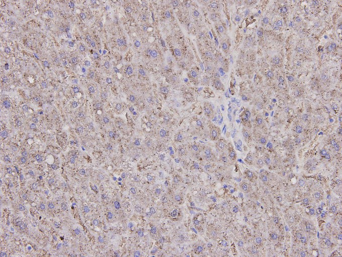 Immunohistochemical analysis of paraffin-embedded human liver tissue using anti-Caspase-1 antibody. The section was pre-treated using heat mediated antigen retrieval with Tris-EDTA buffer (pH 8.0-8.4) for 20 minutes.The tissues were blocked in 5% BSA for 30 minutes at room temperature, washed with ddH2O and PBS, and then probed with the primary antibody (M1505-2, 1/200) for 30 minutes at room temperature. The detection was performed using an HRP conjugated compact polymer system. DAB was used as the chromogen. Tissues were counterstained with hematoxylin and mounted with DPX.