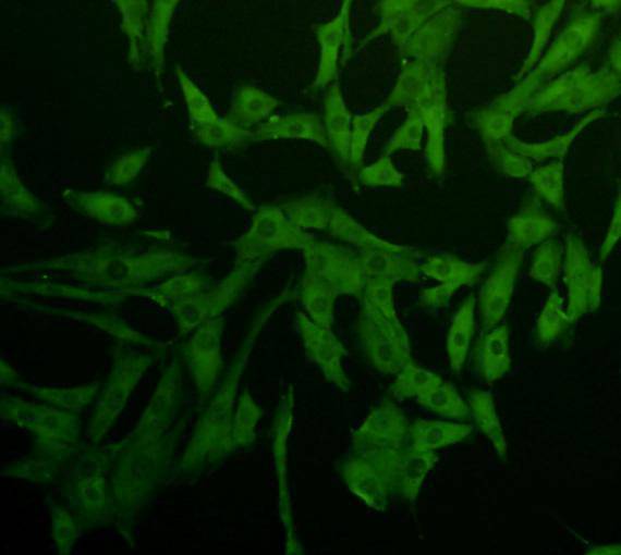 ICC staining of Caspase-1 in NIH/3T3 cells (green). Formalin fixed cells were permeabilized with 0.1% Triton X-100 in TBS for 10 minutes at room temperature and blocked with 1% Blocker BSA for 15 minutes at room temperature. Cells were probed with the primary antibody (M1505-2, 1/200) for 1 hour at room temperature, washed with PBS. Alexa Fluor®488 Goat anti-Rabbit IgG was used as the secondary antibody at 1/1,000 dilution. The nuclear counter stain is DAPI (blue).