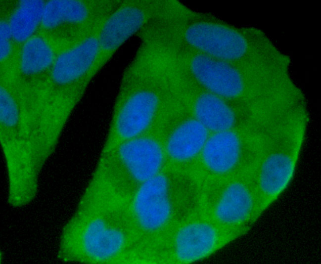 ICC staining Glucose Transporter GLUT4 in Hela cells (green). Formalin fixed cells were permeabilized with 0.1% Triton X-100 in TBS for 10 minutes at room temperature and blocked with 1% Blocker BSA for 15 minutes at room temperature. Cells were probed with Glucose Transporter GLUT4 monoclonal antibody at a dilution of 1:100 for 1 hour at room temperature, washed with PBS. Alexa Fluorc™ 488 Goat anti-Mouse IgG was used as the secondary antibody at 1/100 dilution. The nuclear counter stain is DAPI (blue).