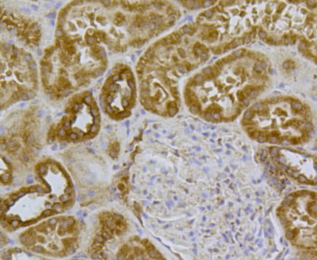 Immunohistochemical analysis of paraffin-embedded human kidney tissue using anti-Glucose Transporter GLUT4 antibody. The section was pre-treated using heat mediated antigen retrieval with Tris-EDTA buffer (pH 8.0-8.4) for 20 minutes.The tissues were blocked in 5% BSA for 30 minutes at room temperature, washed with ddH2O and PBS, and then probed with the antibody (M1505-6) at 1/100 dilution, for 30 minutes at room temperature and detected using an HRP conjugated compact polymer system. DAB was used as the chromogen. Counter stained with hematoxylin and mounted with DPX.