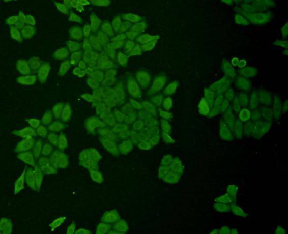 ICC staining ICAM1 in HepG2 cells (green). Cells were fixed in paraformaldehyde, permeabilised with 0.25% Triton X100/PBS.