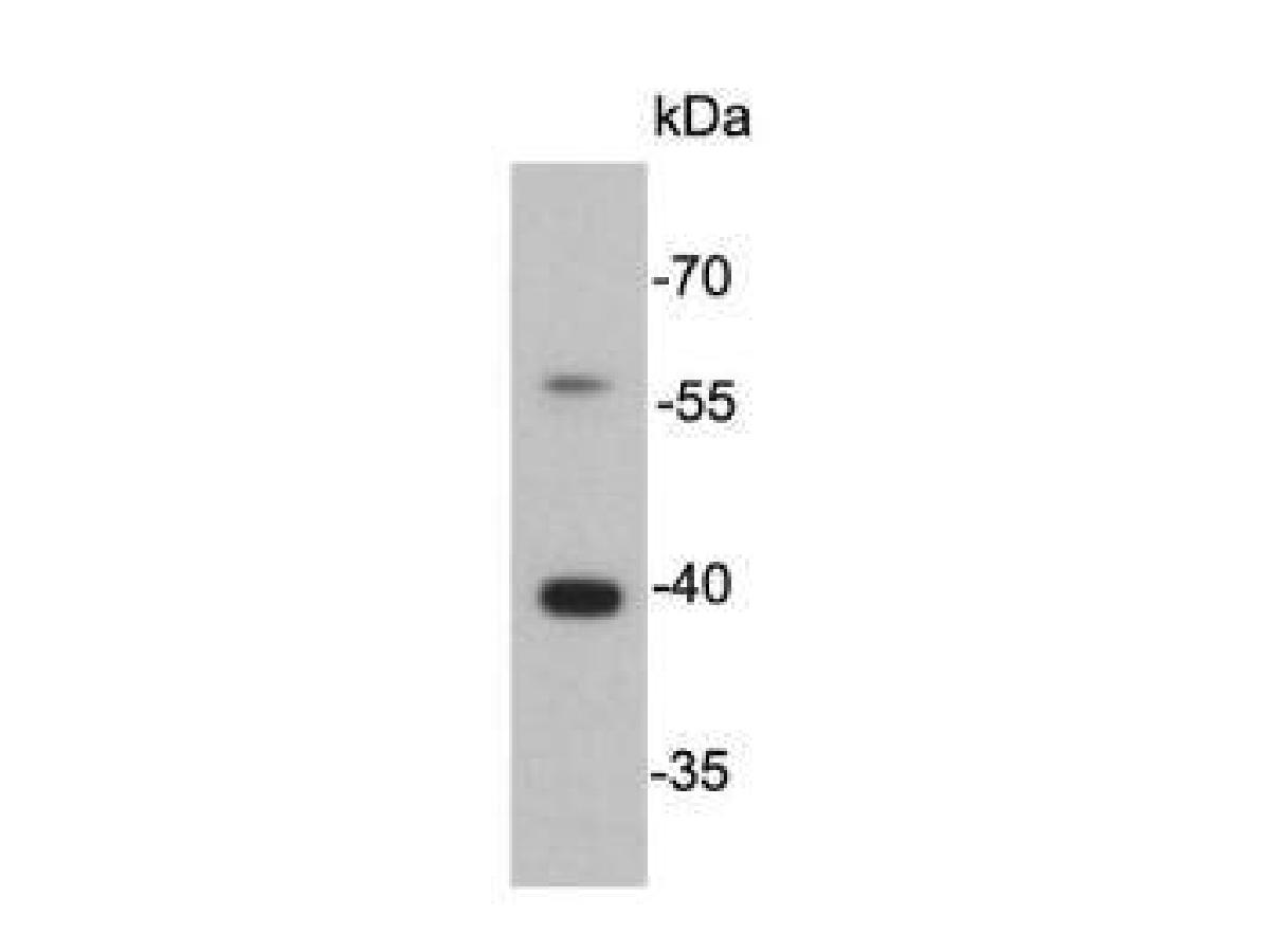 Western blot analysis of Cathepsin B on SW480 cell lysate using anti-Cathepsin B antibody at 1/5,000 dilution.