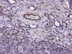 Immunohistochemical analysis of paraffin-embedded human tonsil tissue using anti-CD34 mouse mAb.
