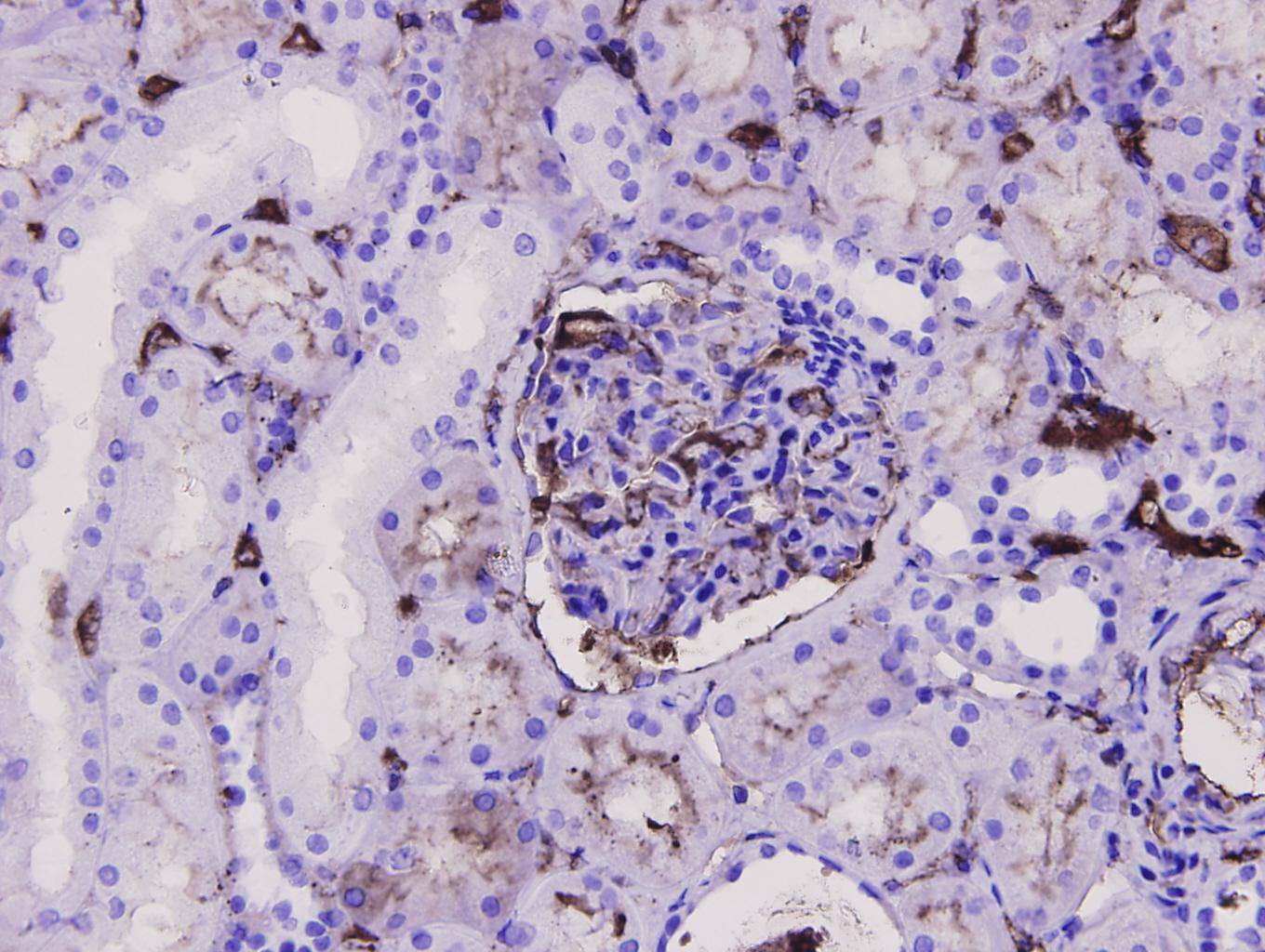 Immunohistochemical analysis of paraffin-embedded human kidney tissue using anti- CD34 mouse mAb.