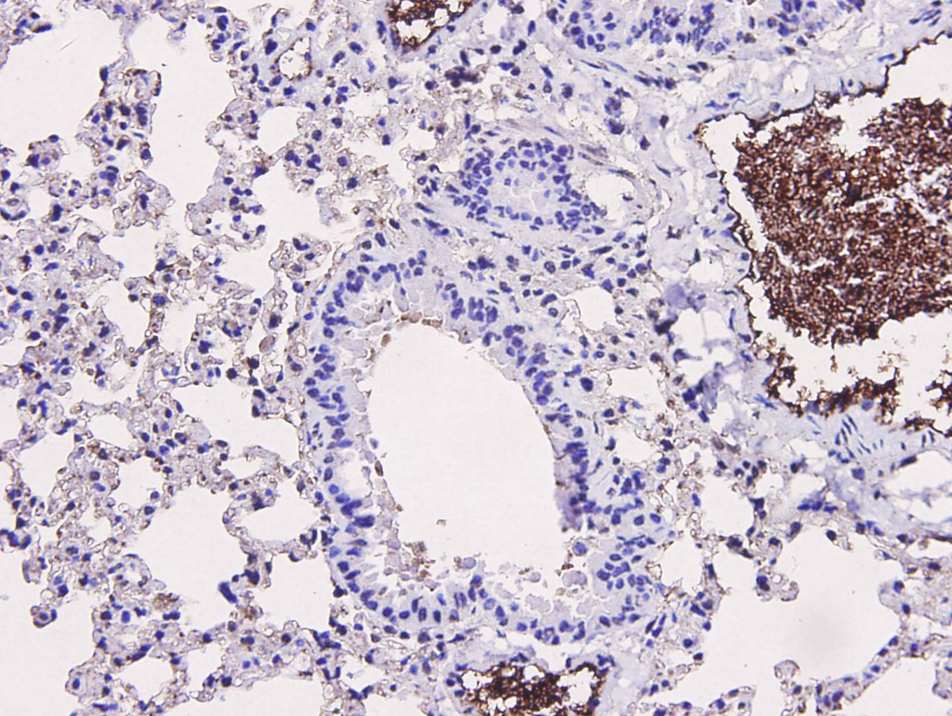 Immunohistochemical analysis of paraffin-embedded mouse lung tissue using anti- CD34 mouse mAb.