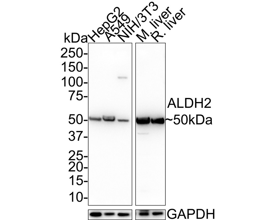 Western blot analysis of ALDH2 on different lysates with Mouse anti-ALDH2 antibody (M1509-1) at 1/1,000 dilution.<br />
<br />
Lane 1: HepG2 cell lysate (20 µg/Lane)<br />
Lane 2: A549 cell lysate (20 µg/Lane)<br />
Lane 3: NIH/3T3 cell lysate (20 µg/Lane)<br />
Lane 4: Mouse liver tissue lysate (40 µg/Lane)<br />
Lane 5: Rat liver tissue lysate (40 µg/Lane)<br />
<br />
Predicted band size: 56 kDa<br />
Observed band size: 50 kDa<br />
<br />
Exposure time: 40 seconds;<br />
<br />
4-20% SDS-PAGE gel.<br />
<br />
Proteins were transferred to a PVDF membrane and blocked with 5% NFDM/TBST for 1 hour at room temperature. The primary antibody (M1509-1) at 1/1,000 dilution was used in 5% NFDM/TBST at room temperature for 2 hours. Goat Anti-Mouse IgG - HRP Secondary Antibody (HA1006) at 1/100,000 dilution was used for 1 hour at room temperature.