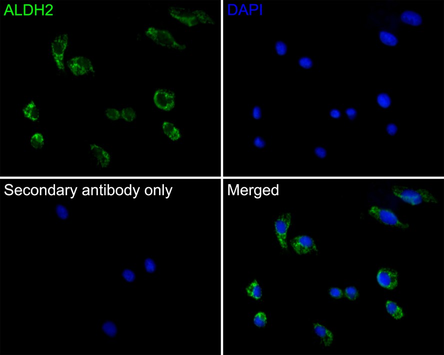 Immunocytochemistry analysis of SK-Br-3 cells labeling ALDH2 with Mouse anti-ALDH2 antibody (M1509-1) at 1/50 dilution.<br />
<br />
Cells were fixed in 4% paraformaldehyde for 30 minutes, permeabilized with 0.1% Triton X-100 in PBS for 15 minutes, and then blocked with 2% BSA for 30 minutes at room temperature. Cells were then incubated with Mouse anti-ALDH2 antibody (M1509-1) at 1/50 dilution in 2% BSA overnight at 4 ℃. Goat Anti-Mouse IgG H&L (iFluor™ 488, HA1125) was used as the secondary antibody at 1/1,000 dilution. PBS instead of the primary antibody was used as the secondary antibody only control. Nuclear DNA was labelled in blue with DAPI.