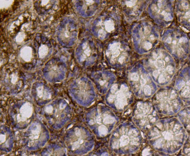 Immunohistochemical analysis of paraffin- embedded mouse colon tissue using anti-ALDH2 Mouse mAb.