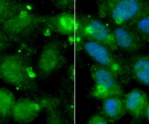 ICC staining AK6 in MCF-7 cells (green). The nuclear counter stain is DAPI (blue). Cells were fixed in paraformaldehyde, permeabilised with 0.25% Triton X100/PBS.