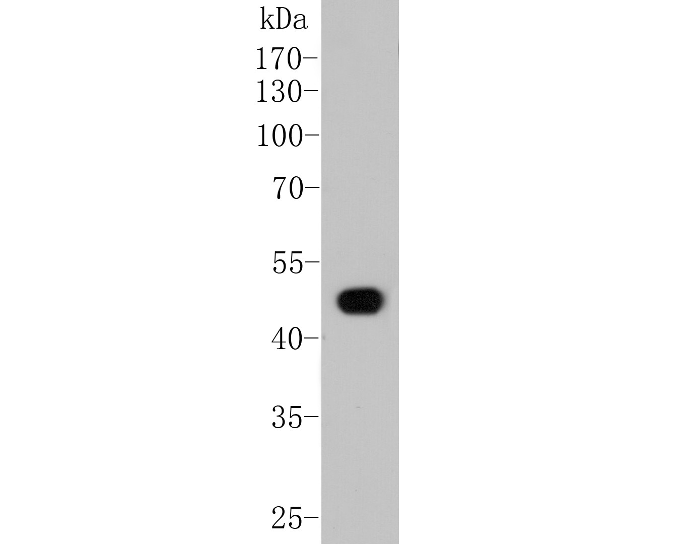 Western blot analysis of Fibrinogen on HepG2 cell lysate. Proteins were transferred to a PVDF membrane and blocked with 5% BSA in PBS for 1 hour at room temperature. The primary antibody (M1510-11, 1/100) was used in 5% BSA at room temperature for 2 hours. Goat Anti-Mouse IgG - HRP Secondary Antibody (HA1006) at 1:5,000 dilution was used for 1 hour at room temperature.