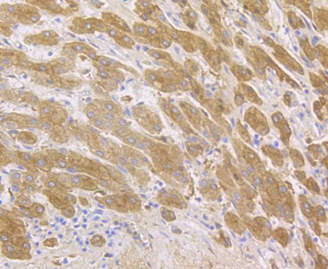 Immunohistochemical analysis of paraffin-embedded human liver tissue using anti-Fibrinogen antibody. The section was pre-treated using heat mediated antigen retrieval with Tris-EDTA buffer (pH 8.0-8.4) for 20 minutes.The tissues were blocked in 5% BSA for 30 minutes at room temperature, washed with ddH2O and PBS, and then probed with the antibody (M1510-11) at 1/50 dilution, for 30 minutes at room temperature and detected using an HRP conjugated compact polymer system. DAB was used as the chromogen. Counter stained with hematoxylin and mounted with DPX.