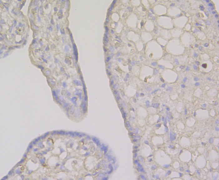 Immunohistochemical analysis of paraffin-embedded human placenta tissue using anti-Fibrinogen antibody. The section was pre-treated using heat mediated antigen retrieval with Tris-EDTA buffer (pH 8.0-8.4) for 20 minutes.The tissues were blocked in 5% BSA for 30 minutes at room temperature, washed with ddH2O and PBS, and then probed with the antibody (M1510-11) at 1/50 dilution, for 30 minutes at room temperature and detected using an HRP conjugated compact polymer system. DAB was used as the chromogen. Counter stained with hematoxylin and mounted with DPX.