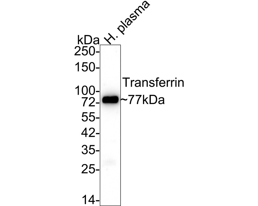 Western blot analysis of Transferrin on human plasma with Mouse anti-Transferrin antibody (M1510-17) at 1/1,000 dilution.<br />
<br />
Lysates/proteins at 20 µg/Lane.<br />
<br />
Predicted band size: 77 kDa<br />
Observed band size: 77 kDa<br />
<br />
Exposure time: 2 minutes;<br />
<br />
4-20% SDS-PAGE gel.<br />
<br />
Proteins were transferred to a PVDF membrane and blocked with 5% NFDM/TBST for 1 hour at room temperature. The primary antibody (M1510-17) at 1/1,000 dilution was used in 5% NFDM/TBST at 4℃ overnight. Goat Anti-Mouse IgG - HRP Secondary Antibody (HA1006) at 1/50,000 dilution was used for 1 hour at room temperature.