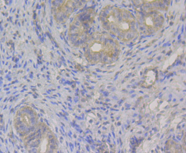 Immunohistochemical analysis of paraffin-embedded rat uterus tissue using anti-Transferrin antibody. The section was pre-treated using heat mediated antigen retrieval with sodium citrate buffer (pH 6.0) for 20 minutes. The tissues were blocked in 5% BSA for 30 minutes at room temperature, washed with ddH2O and PBS, and then probed with the antibody (M1510-17) at 1/200 dilution, for 30 minutes at room temperature and detected using an HRP conjugated compact polymer system. DAB was used as the chrogen. Counter stained with hematoxylin and mounted with DPX.