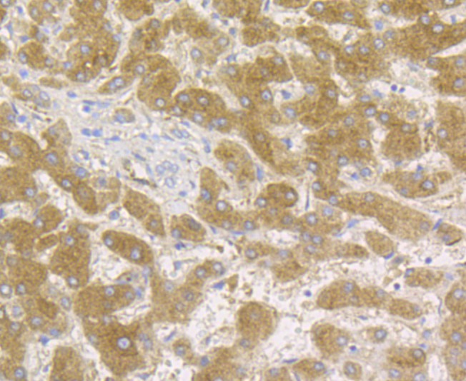 Immunohistochemical analysis of paraffin-embedded human liver tissue using anti-Transferrin antibody. The section was pre-treated using heat mediated antigen retrieval with sodium citrate buffer (pH 6.0) for 20 minutes. The tissues were blocked in 5% BSA for 30 minutes at room temperature, washed with ddH2O and PBS, and then probed with the antibody (M1510-17) at 1/200 dilution, for 30 minutes at room temperature and detected using an HRP conjugated compact polymer system. DAB was used as the chrogen. Counter stained with hematoxylin and mounted with DPX.