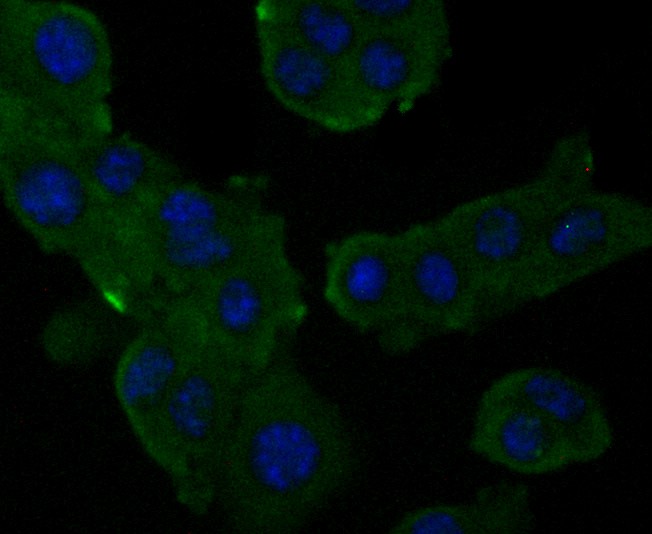 ICC staining Alpha-2-macroglobulin in H22 cells (green). Formalin fixed cells were permeabilized with 0.1% Triton X-100 in TBS for 10 minutes at room temperature and blocked with 1% Blocker BSA for 15 minutes at room temperature. Cells were probed with Alpha-2-macroglobulin monoclonal antibody at a dilution of 1:50 for at least 1 hour at room temperature, washed with PBS. Alexa Fluorc™ 488 Goat anti-Mouse IgG was used as the secondary antibody at 1/100 dilution. The nuclear counter stain is DAPI (blue).