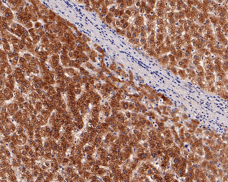 Immunohistochemical analysis of paraffin-embedded human liver tissue with Mouse anti-Alpha-2-macroglobulin antibody (M1510-23) at 1/200 dilution.<br />
<br />
The section was pre-treated using heat mediated antigen retrieval with Tris-EDTA buffer (pH 9.0) for 20 minutes. The tissues were blocked in 1% BSA for 20 minutes at room temperature, washed with ddH2O and PBS, and then probed with the primary antibody (M1510-23) at 1/200 dilution for 1 hour at room temperature. The detection was performed using an HRP conjugated compact polymer system. DAB was used as the chromogen. Tissues were counterstained with hematoxylin and mounted with DPX.