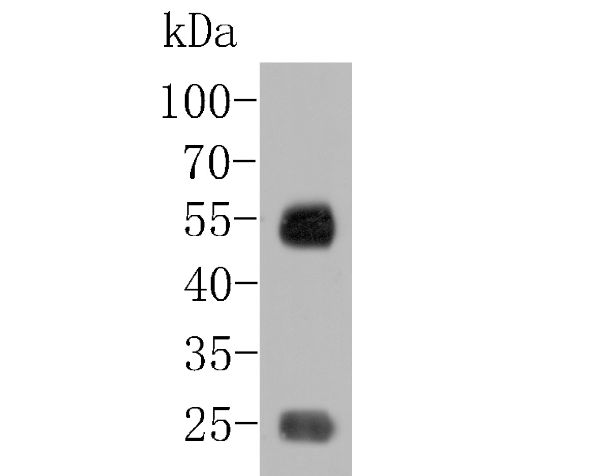 Western blot analysis of IgA on human plasma tissue lysates. Proteins were transferred to a PVDF membrane and blocked with 5% BSA in PBS for 1 hour at room temperature. The primary antibody (M1510-29, 1/500) was used in 5% BSA at room temperature for 2 hours. Goat Anti-Mouse IgG - HRP Secondary Antibody (HA1006) at 1:5,000 dilution was used for 1 hour at room temperature.