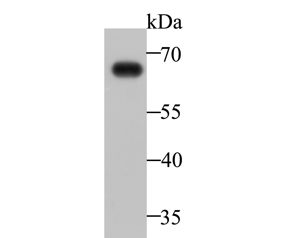 Western blot analysis of IgA on human plasma lysate. Proteins were transferred to a PVDF membrane and blocked with 5% BSA in PBS for 1 hour at room temperature. The primary antibody was used at a 1/500 dilution in 5% BSA at room temperature for 2 hours. Goat Anti-Mouse IgG - HRP Secondary Antibody (HA1006) at 1:5,000 dilution was used for 1 hour at room temperature.