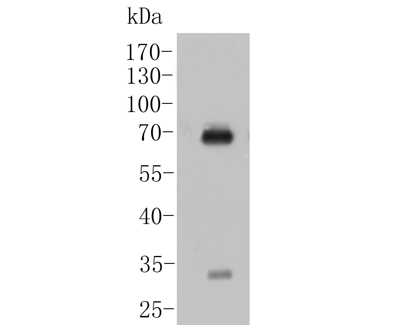 Western blot analysis of IgA on Human plasma tissue lysates. Proteins were transferred to a PVDF membrane and blocked with 5% BSA in PBS for 1 hour at room temperature. The primary antibody (M1510-31, 1/1,000) was used in 5% BSA at room temperature for 2 hours. Goat Anti-Mouse IgG - HRP Secondary Antibody (HA1006) at 1:5,000 dilution was used for 1 hour at room temperature.
