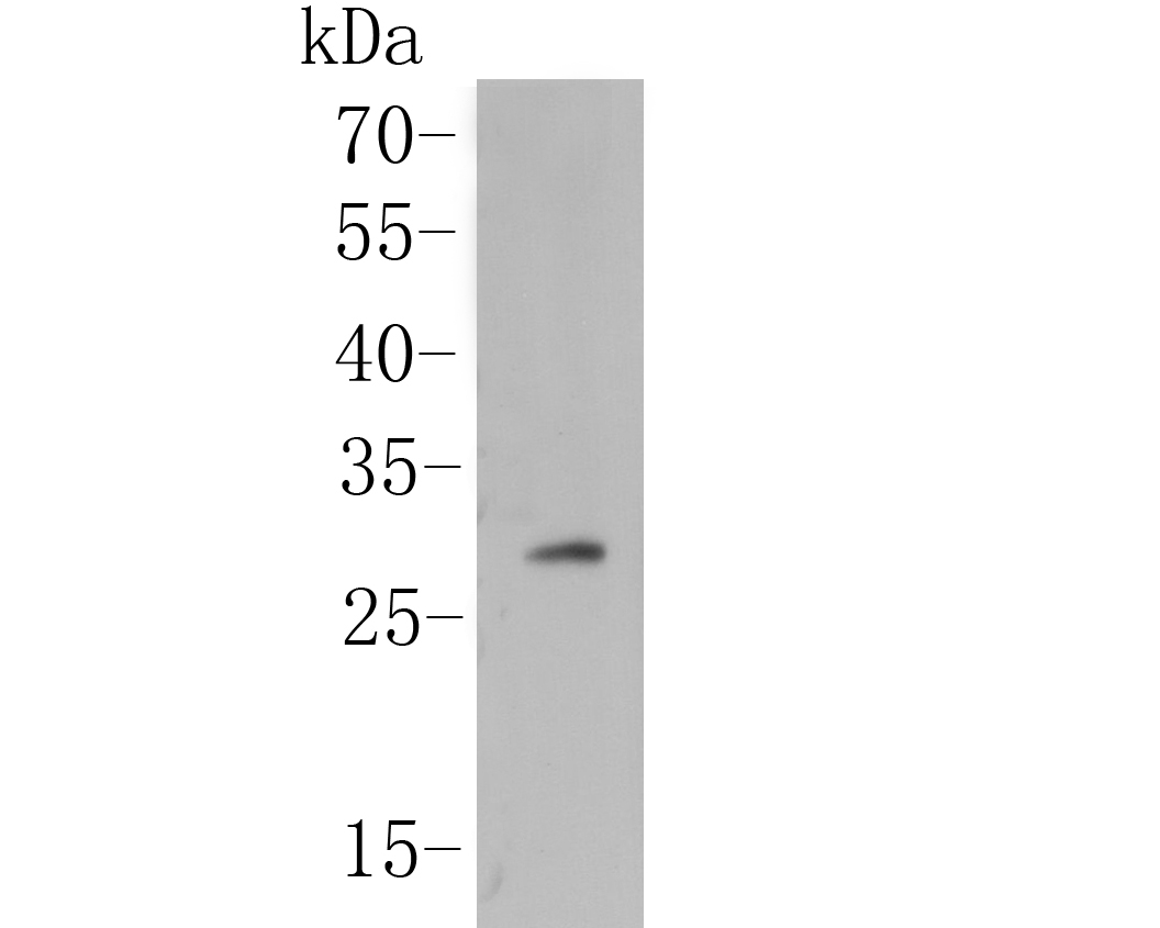 Western blot analysis of human IgM on recombinant proteint lysate. Proteins were transferred to a PVDF membrane and blocked with 5% BSA in PBS for 1 hour at room temperature. The primary antibody (M1510-5, 1/500) was used in 5% BSA at room temperature for 2 hours. Goat Anti-Mouse IgG - HRP Secondary Antibody (HA1006) at 1:5,000 dilution was used for 1 hour at room temperature.