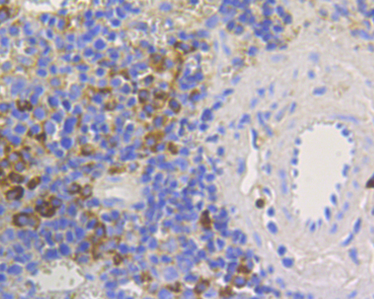 Immunohistochemical analysis of paraffin-embedded mouse spleen tissue using anti-human IgM antibody. The section was pre-treated using heat mediated antigen retrieval with Tris-EDTA buffer (pH 8.0-8.4) for 20 minutes.The tissues were blocked in 5% BSA for 30 minutes at room temperature, washed with ddH2O and PBS, and then probed with the primary antibody (M1510-5, 1/200) for 30 minutes at room temperature. The detection was performed using an HRP conjugated compact polymer system. DAB was used as the chromogen. Tissues were counterstained with hematoxylin and mounted with DPX.