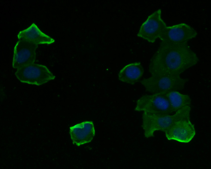 ICC staining of HDAC3 in MCF-7 cells (green). Formalin fixed cells were permeabilized with 0.1% Triton X-100 in TBS for 10 minutes at room temperature and blocked with 1% Blocker BSA for 15 minutes at room temperature. Cells were probed with the primary antibody (M1511-3, 1/50) for 1 hour at room temperature, washed with PBS. Alexa Fluor®488 Goat anti-Mouse IgG was used as the secondary antibody at 1/1,000 dilution. The nuclear counter stain is DAPI (blue).