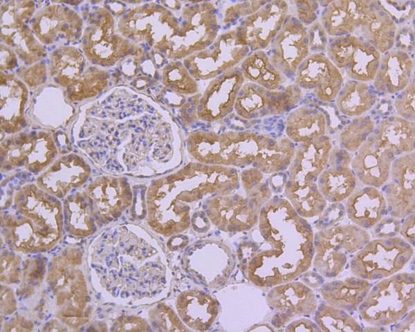 Immunohistochemical analysis of paraffin-embedded human kidney tissue using anti-HDAC3 antibody. The section was pre-treated using heat mediated antigen retrieval with Tris-EDTA buffer (pH 8.0-8.4) for 20 minutes.The tissues were blocked in 5% BSA for 30 minutes at room temperature, washed with ddH2O and PBS, and then probed with the primary antibody (M1511-3, 1/200) for 30 minutes at room temperature. The detection was performed using an HRP conjugated compact polymer system. DAB was used as the chromogen. Tissues were counterstained with hematoxylin and mounted with DPX.